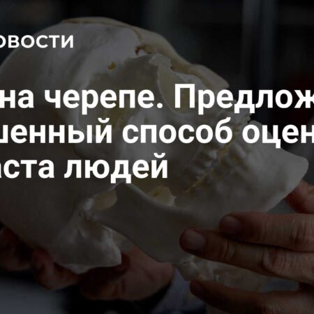 Швы на черепе. Предложен улучшенный способ оценки возраста людей