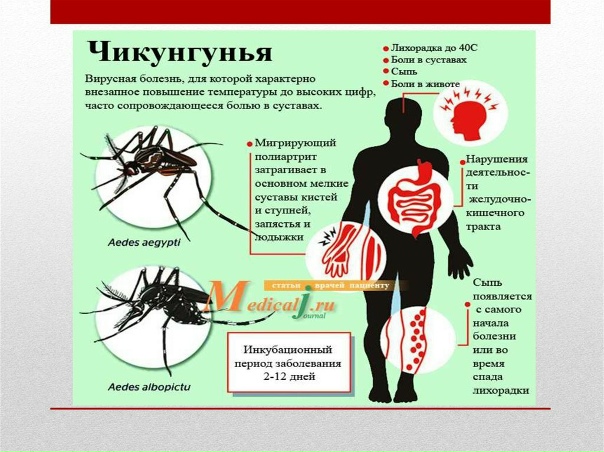 Preview Чикунгунья: есть ли угроза для России и как защититься