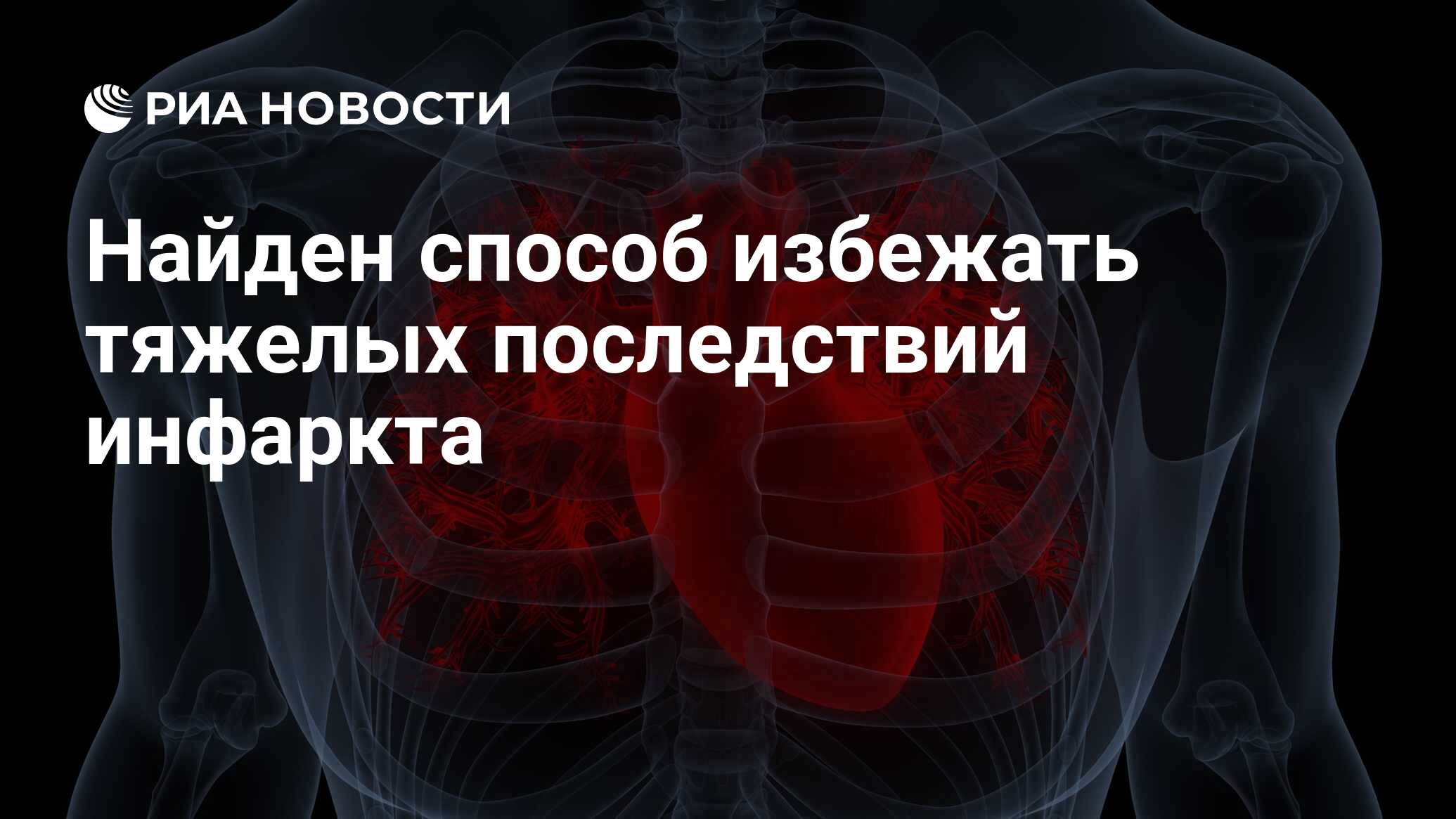 Preview Найден способ избежать тяжелых последствий инфаркта