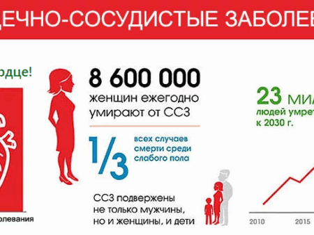 Успехи в борьбе: смертность от сердечно-сосудистых заболеваний в России существенно снизилась