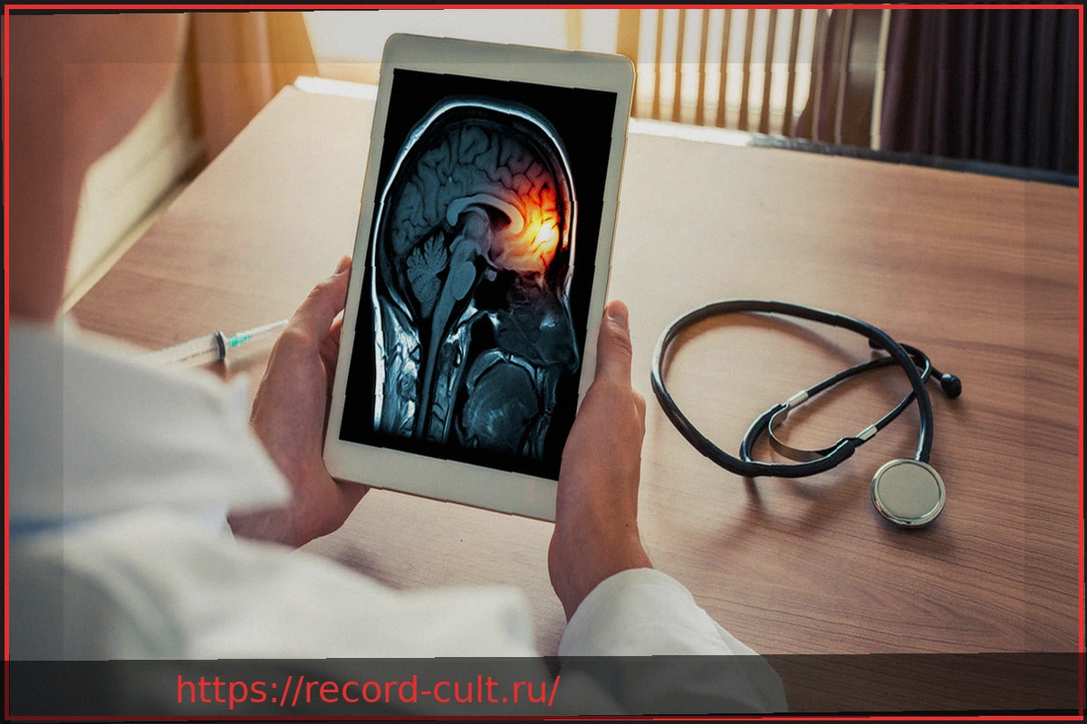 Preview Вспышка менингита в Англии: есть ли угроза для России?