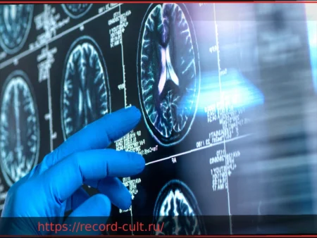 Исследование: Треть случаев деменции в Германии можно предотвратить