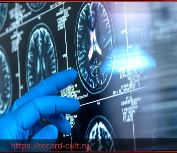Исследование: Треть случаев деменции в Германии можно предотвратить