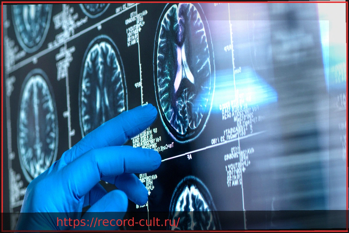 Preview Исследование: Треть случаев деменции в Германии можно предотвратить